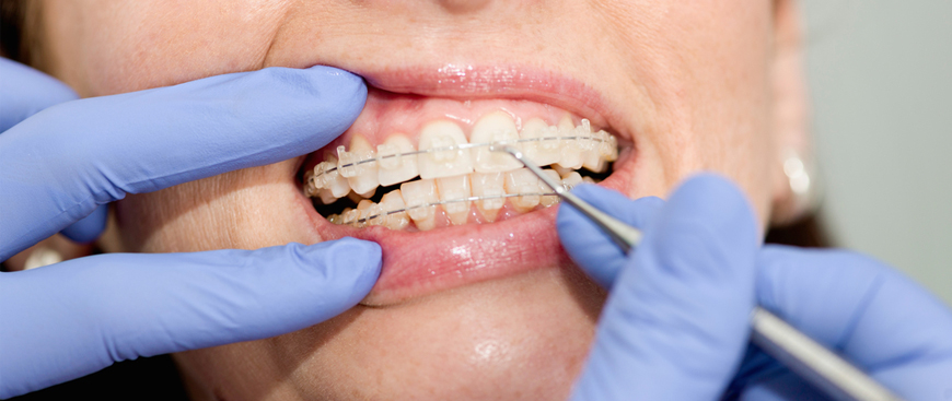 Ortodoncia ortopedia